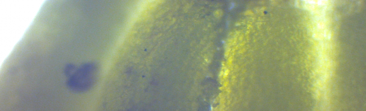 Microscopic view of Solanum